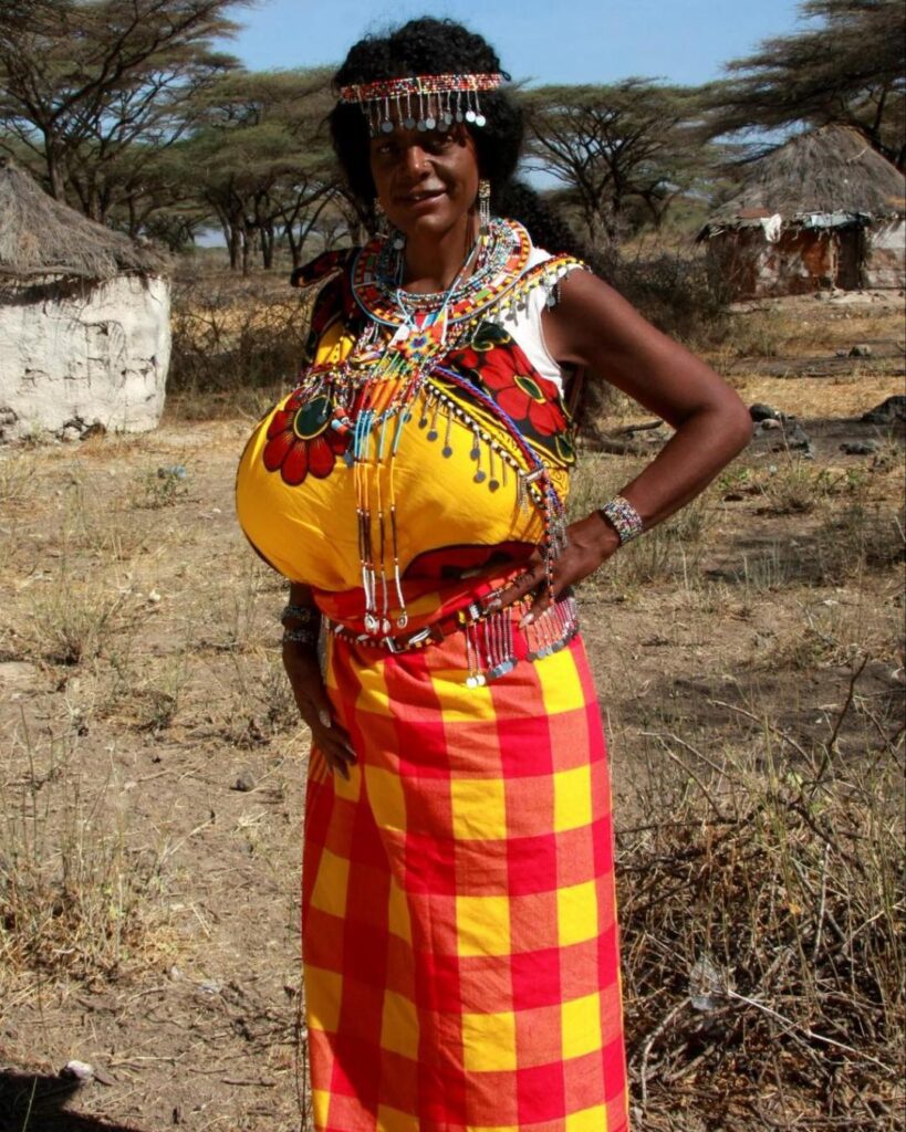 German Model Martina Big Injects Hormone to ‘Become African’ See
